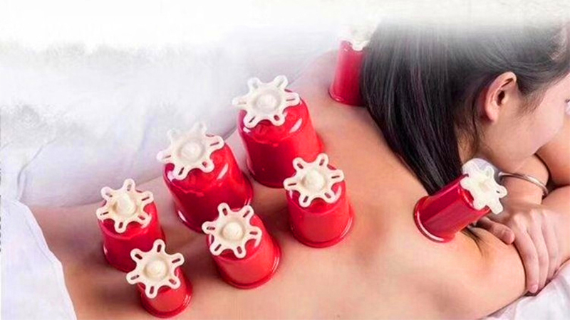 拔罐的好处以及如何正确拔罐